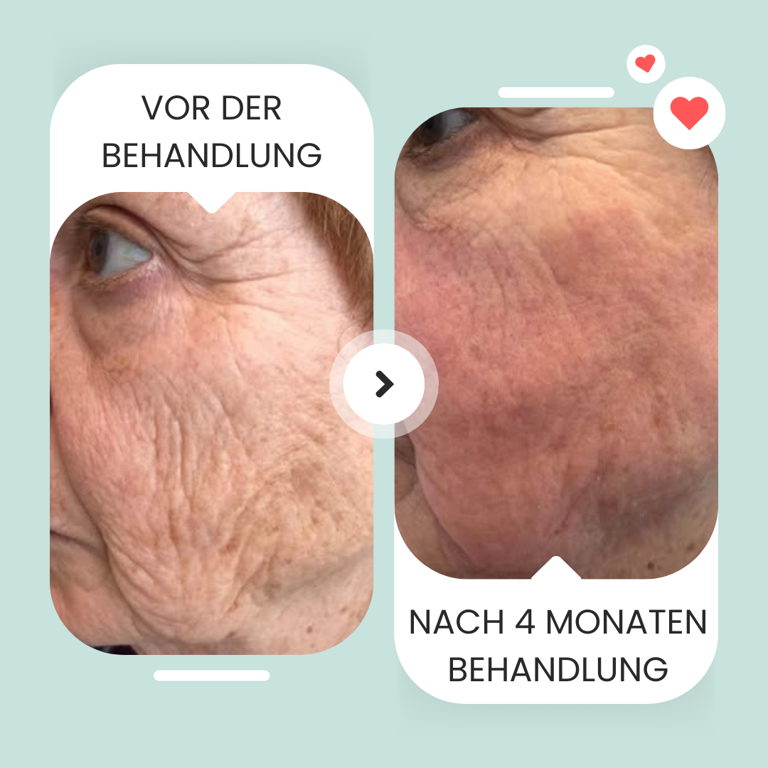 Elloway Derma Infusion Therapy