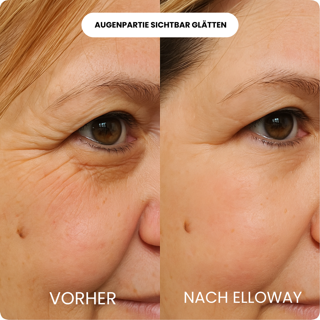 Elloway Derma Infusion Therapy