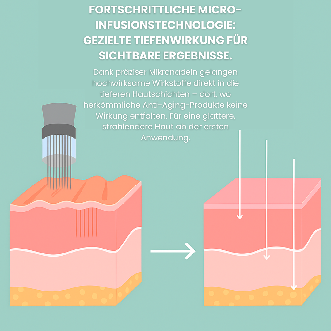 Elloway Micro Infusion System™