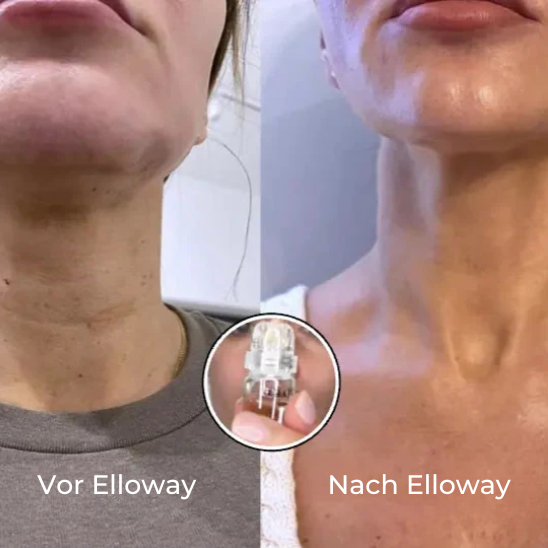 Elloway Mikroinfusionstherapie