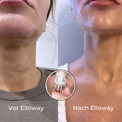 Elloway Mikroinfusionstherapie
