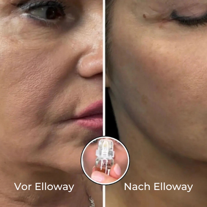 Elloway Mikroinfusionstherapie