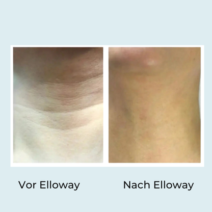 Elloway Mikroinfusionstherapie